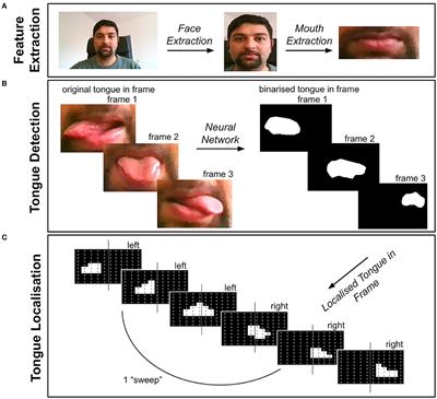 An Automated Tongue Tracker for Quantifying Bulbar Function in ALS